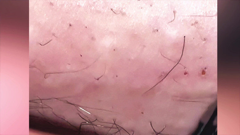 SatisfyingDillyDally: się