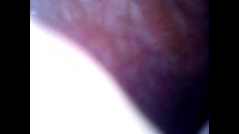 Idmir Sugary: Endoscope Details - Hole Balls Cock Foreskin Belly Nipples Mouth Sperm
