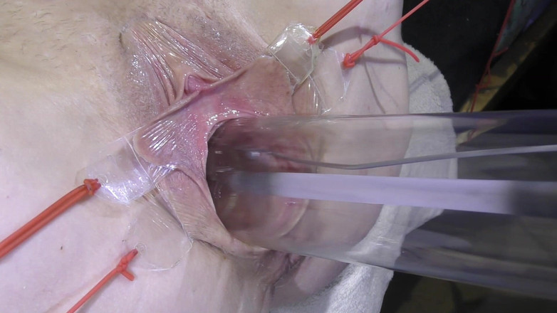 deep keely: Vagina Lontana Da Vicino Che Scopa Con Lampada 1000watt