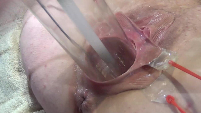 deep keely: 10 Far Spread Pussy Close up Fuck Dengan Lampu 1000 Watt