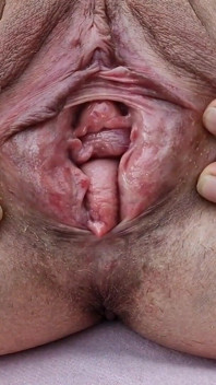 Outdoor Naked Gaping Pussy and Pissing