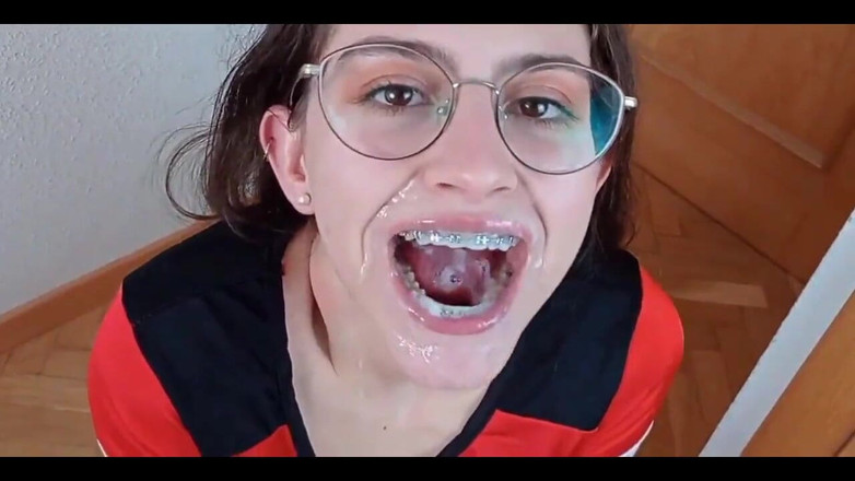 Shanaxnow: Please Cum on My Braces Dirty Talking Teen Blowjob. Shanaxnow