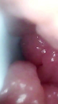 Une Caméra Endoscopique Enregistre Le Point G De Ma Femme. Vidéo Éducative, Gros Plan