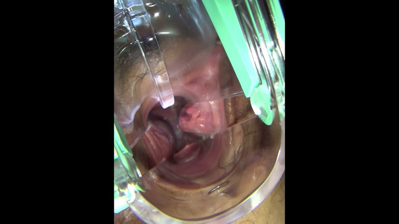 reikodouga: Vaginal Observation Video 1