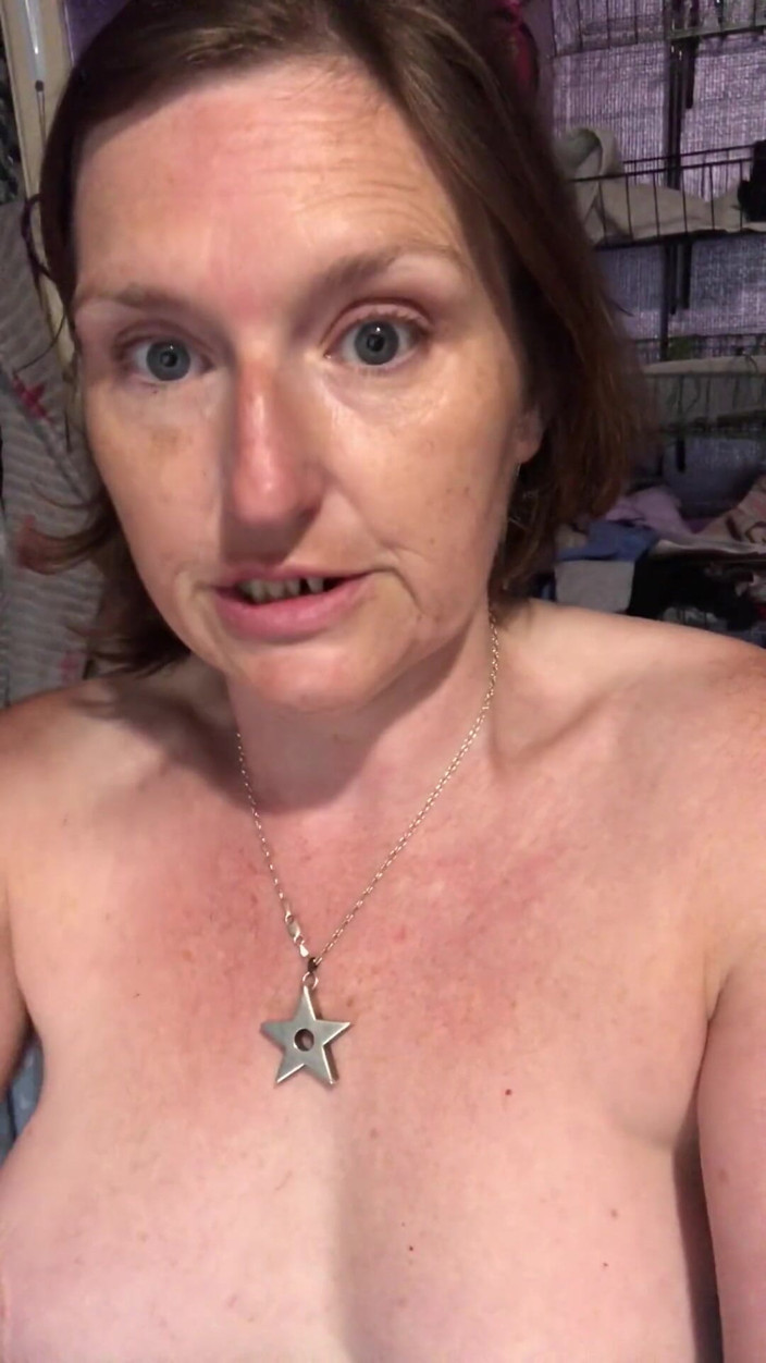 MistressWriggler: Rozprzestrzenianie My Hairy Pussy Lips Apart do cewnika sikanie do...