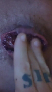 My Hole