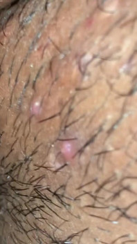Creampie
