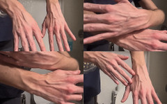 Elaina Button: Extremas veias da mão, mãos maduras, fetiche por veias