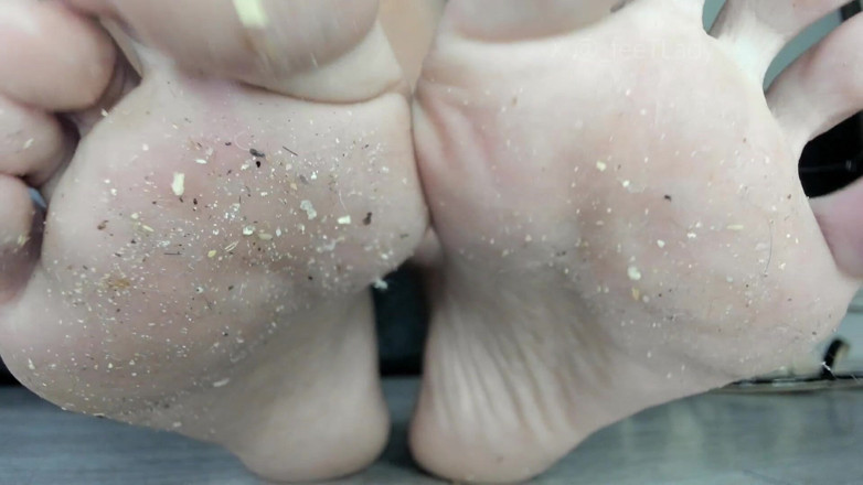Feet lady: Unghie dei piedi sporche e naturali