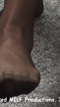Voetfantasieën bunion voeten
