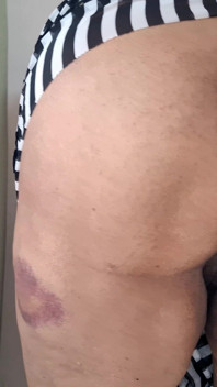 愛してくれ、セックスしろ、それがヨルの義務だ。