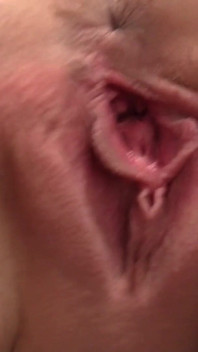 我追捕我的阴户 - 护士vanessa hell在妇科手术中张开她的阴户