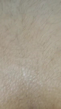 딥 클로즈업