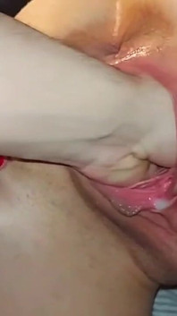 Hot Fisting