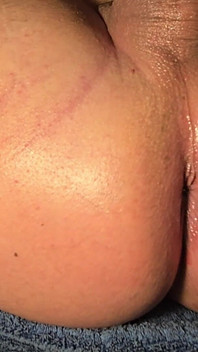Brazilian Wax Asshole