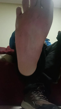 Huele Mis Pies