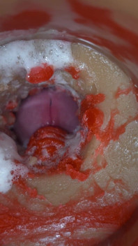 Insemination - Internal Camera Captures Deep Male Ejaculation