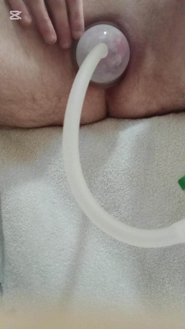 BonusholeToy: Un garçon FTM pompe ses organes génitaux pour vous