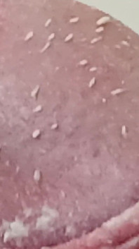 Smegma Foreskin Roll. bigpisser