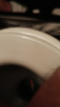 ペニスの尿道への大きな挿入