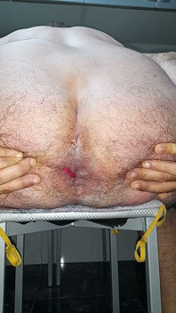 Vibrations Luxuriantes Et Gros Gode Transparent Qui Baisent Mon Cul De Près Du Fond Grand Ouvert
