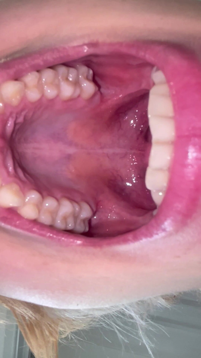 Glitterqueen1999: Deep Inside My MouthのMouth Tour Flash