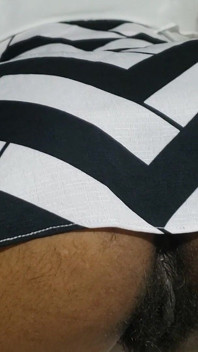 Kronik anal dari memek berbulu, bagian dari memek closeup