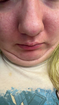 Chin Faces