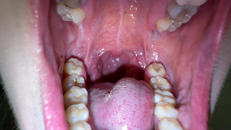 Hottie goddess: Mundgeheimnisse: dicker weißer beschichtung auf meiner zunge