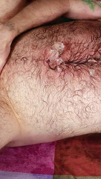 Крижаний холод, але все ще до біса гарячий - ftm ice play