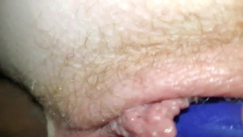 Sharinga: エッチなアナル