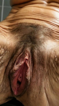 Vulva Typy - Starší ženy