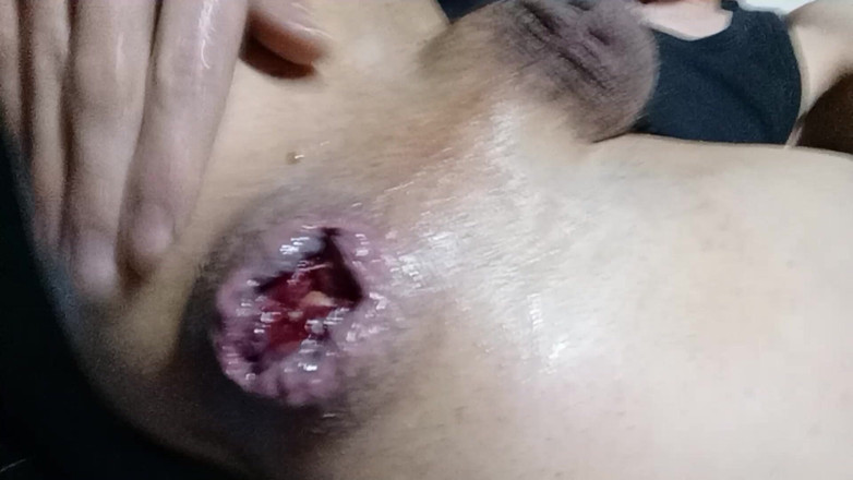 Norbi2888: Permainan dubur ikan