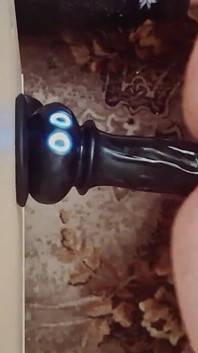 Anal mastürbasyon