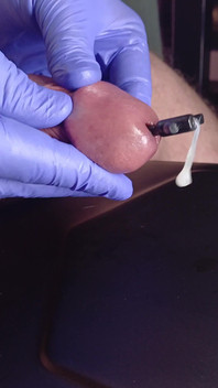 A Gay Dream Comes True, a Dilator in the Devil's Hands