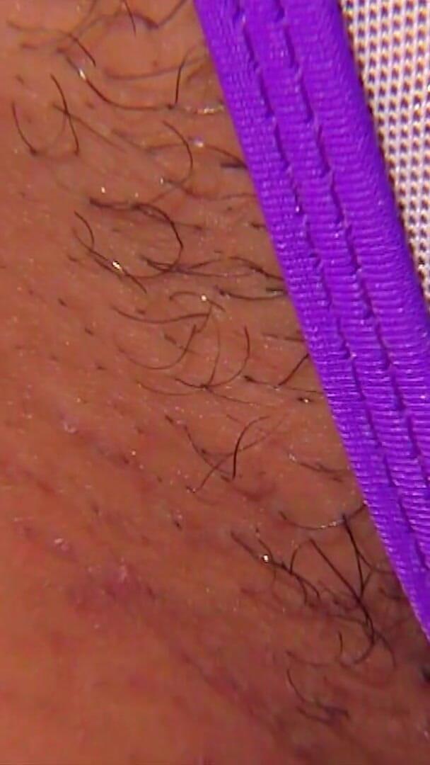BIKINI-POPS: De Garnaal
