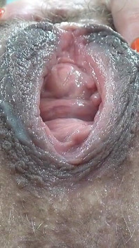 Muy Primer Plano De La Vagina Húmeda Y Peluda Con