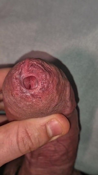 Zblízka na Phimosis Large Cock, tak sexy!