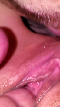 Usually Farting Helps to Find Butthole if It’s Too Hairy