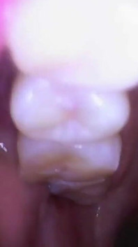 Nel profondo della bocca di Sydney - Sydney urla mostra bocca, lingua, gola e Uvula con l'endoscopio