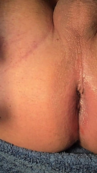Brazilian Wax Asshole