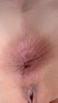 Asshole Close-up Casual Spread