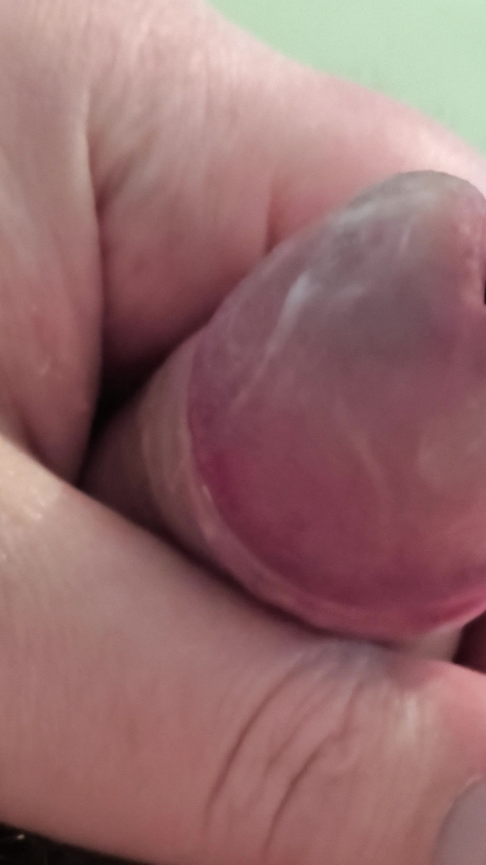 Uglydick: Sân khấu