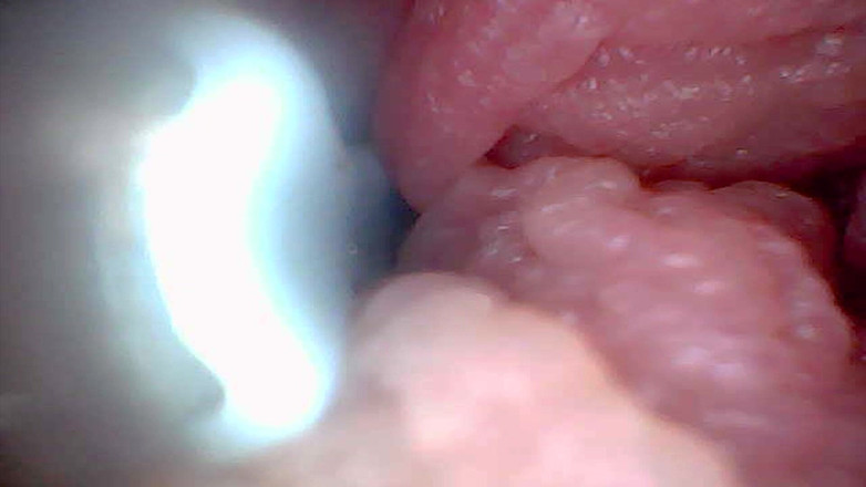 Twittiy: 让我们一起窥视我多汁的阴户（内窥镜相机）