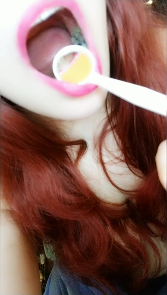 Scarlet Vixen: 歯科鏡検査