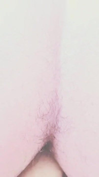 Yapay Penis