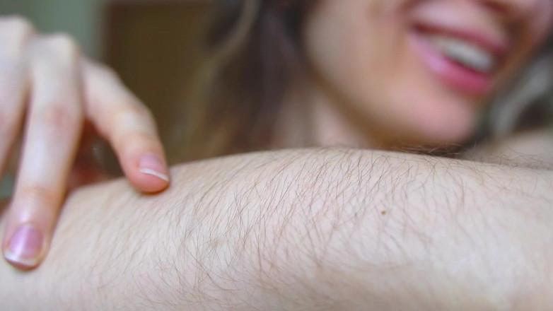 Rarible Diamond: 毛茸茸的手臂和坑