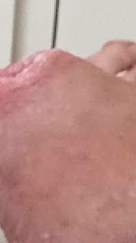 Smegma Foreskin Roll. bigpisser