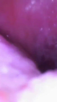 Deep Inside Sydney's Mouth - Sydney Screams Shows off Mouth, Tongue, Throat, and Uvula with Endoscope