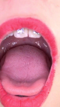 Video de fetiche de boca con Bara mostrando frenillos dentales.